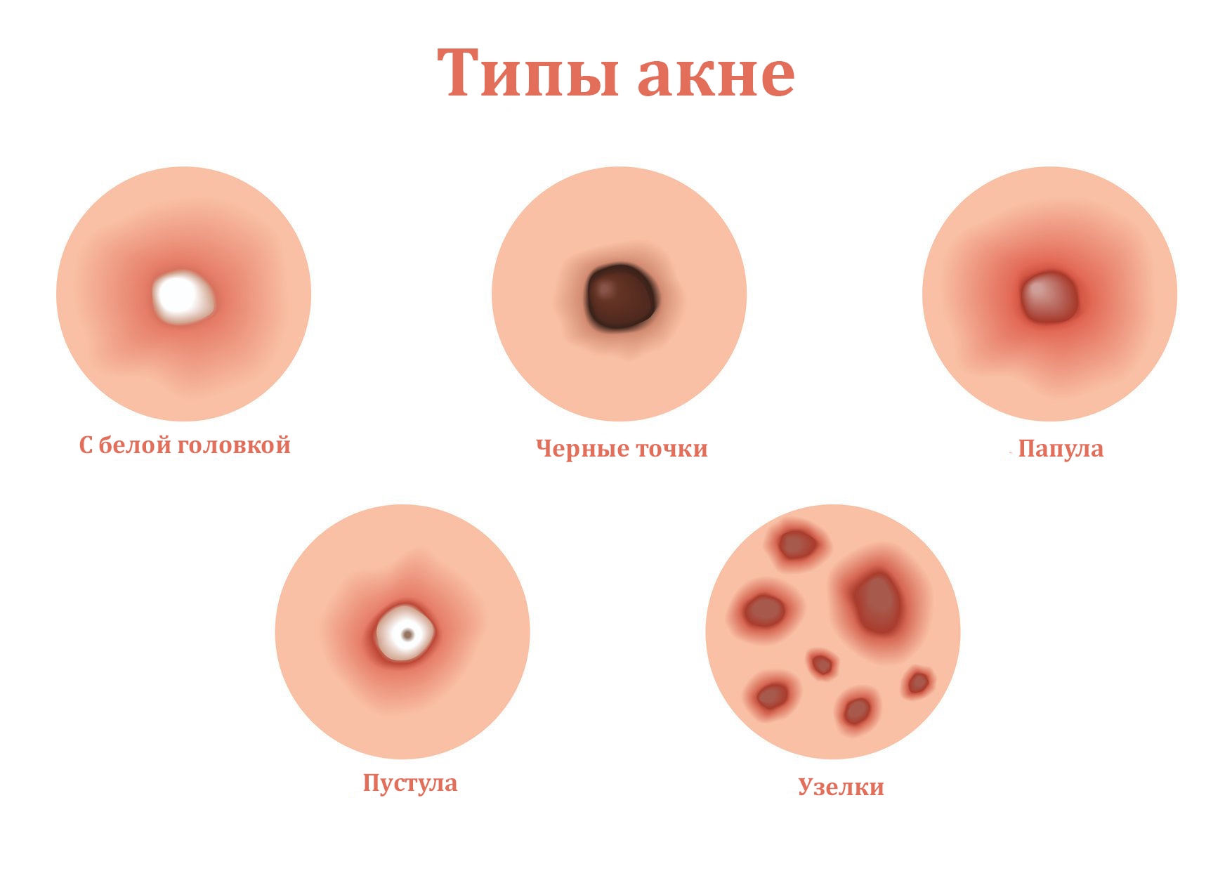 Почему от дивана чешется тело